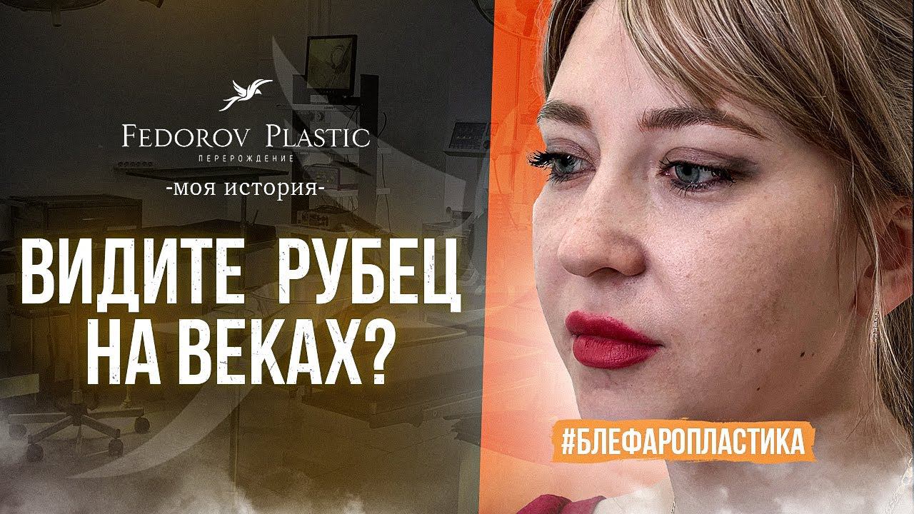 Невидимый рубец после операции / Я не могла в это поверить / Fedorov Plastic