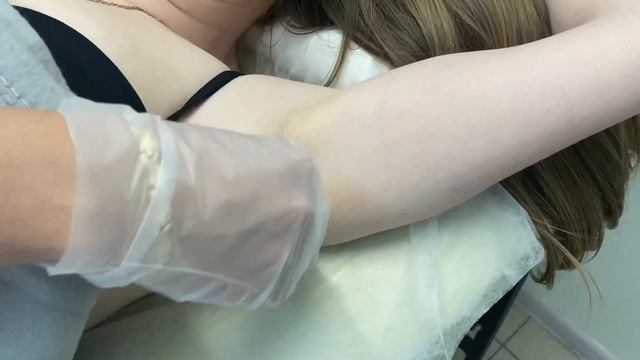 SHR-эпиляция обзор. Первая процедура.