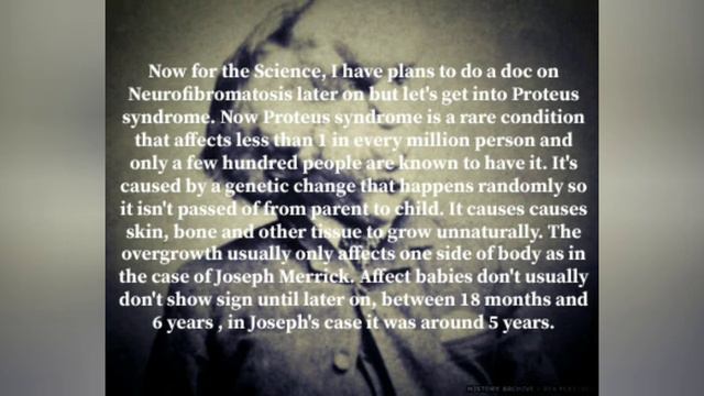The Elephant Man - (Proteus Syndrome And The Sad Case Of Joseph Merrick)