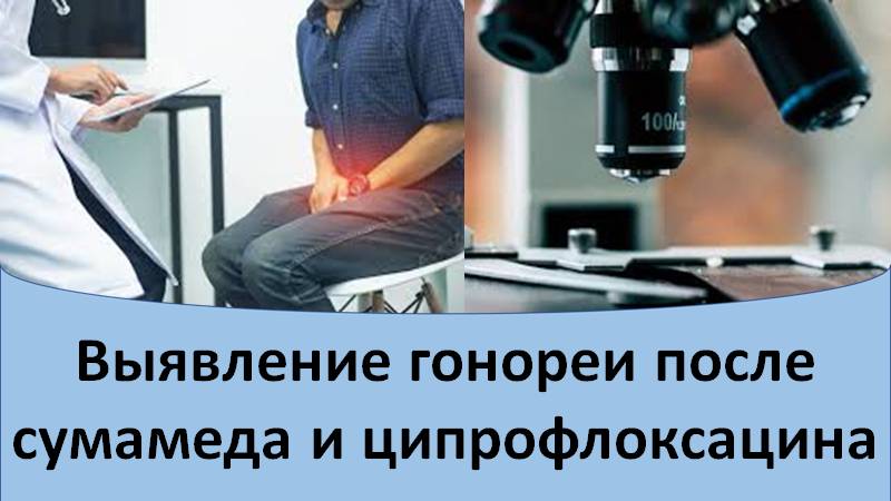 Выявление гонореи после лечения сумамедом и ципрофлоксацином