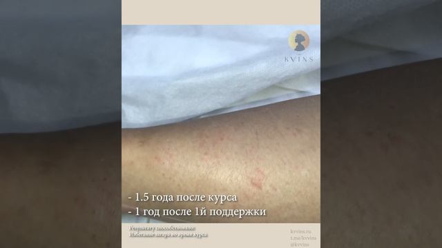 Пример результата после 1.5 лет после курса