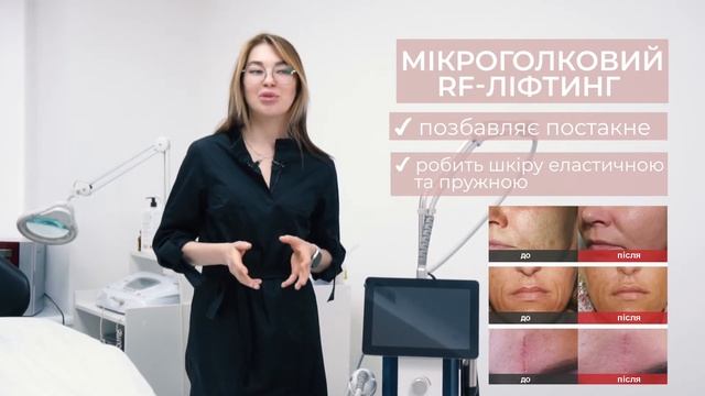 RF-lifting procedure for beauty studio | Процедура RF- ліфтингу для студії краси