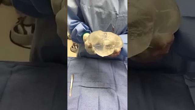 Улучшенные силиконовые импланты
