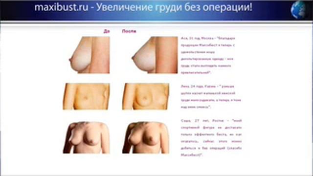 Увеличение груди МаксиБюст