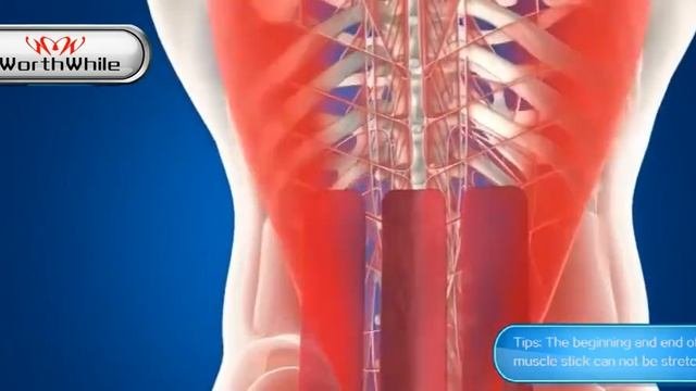 Кинезиологическая лента WorthWhile лента для кинезиотейпирования восстановления обезболивания