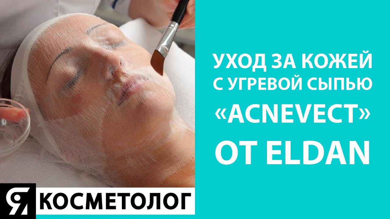 Уход за кожей с угревой сыпью «АКНЕВЕКТ»