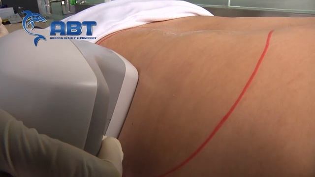 Аппарат V-Shape III Вакуумно-роликовый массаж LPG