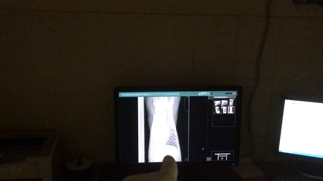 Thoracic x-ray. Dog positioning. Рентгенография грудной полости. Укладка собаки.
