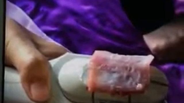 HiFU Energy Test On Pork