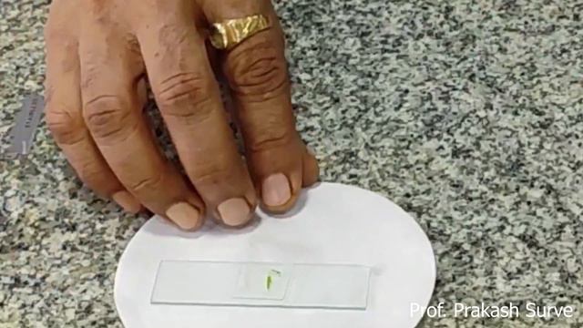 Structure and distribution of Stomata Practical with answers ( Betel leaf ) By Prof. Prakash Surve