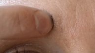 Rapid Brow Part 2 - Day 14 Check In