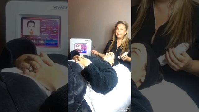 VIvace Microneedling with RF