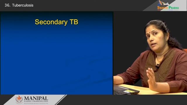Tuberculosis