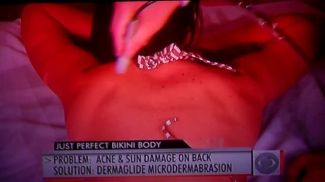 Dermaglide all natural microdermabrasion system featured on CBS Early Show with Dr. Anthony Youn, M