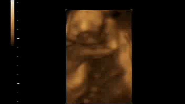 наш Исмаильчик 20 недель.avi