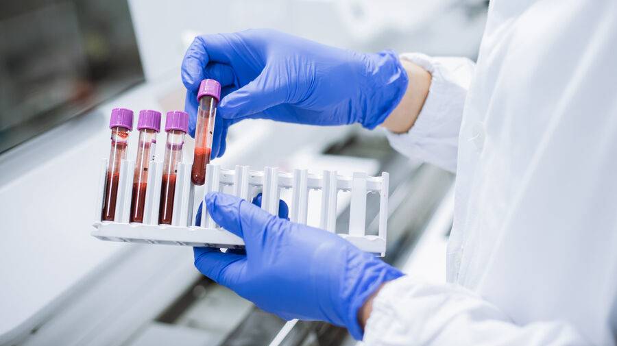 По белкам крови можно прогнозировать более 60 заболеваний, выяснили ученые