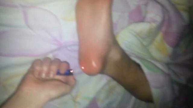 Пятка. ХД