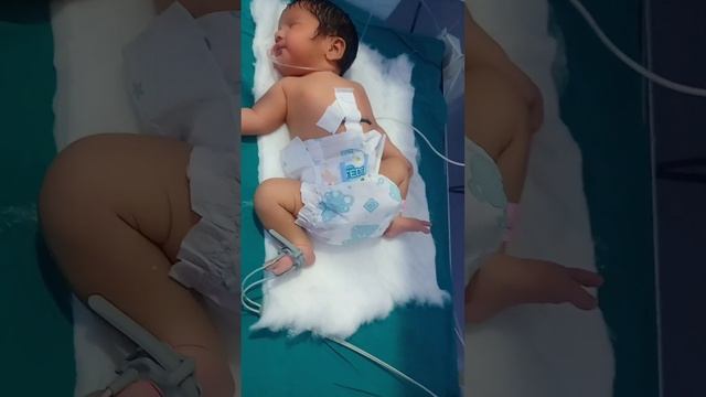 Sleeping Cute Baby In #sncu#nicu#sleep #nursing#newborn#newborngirl..
