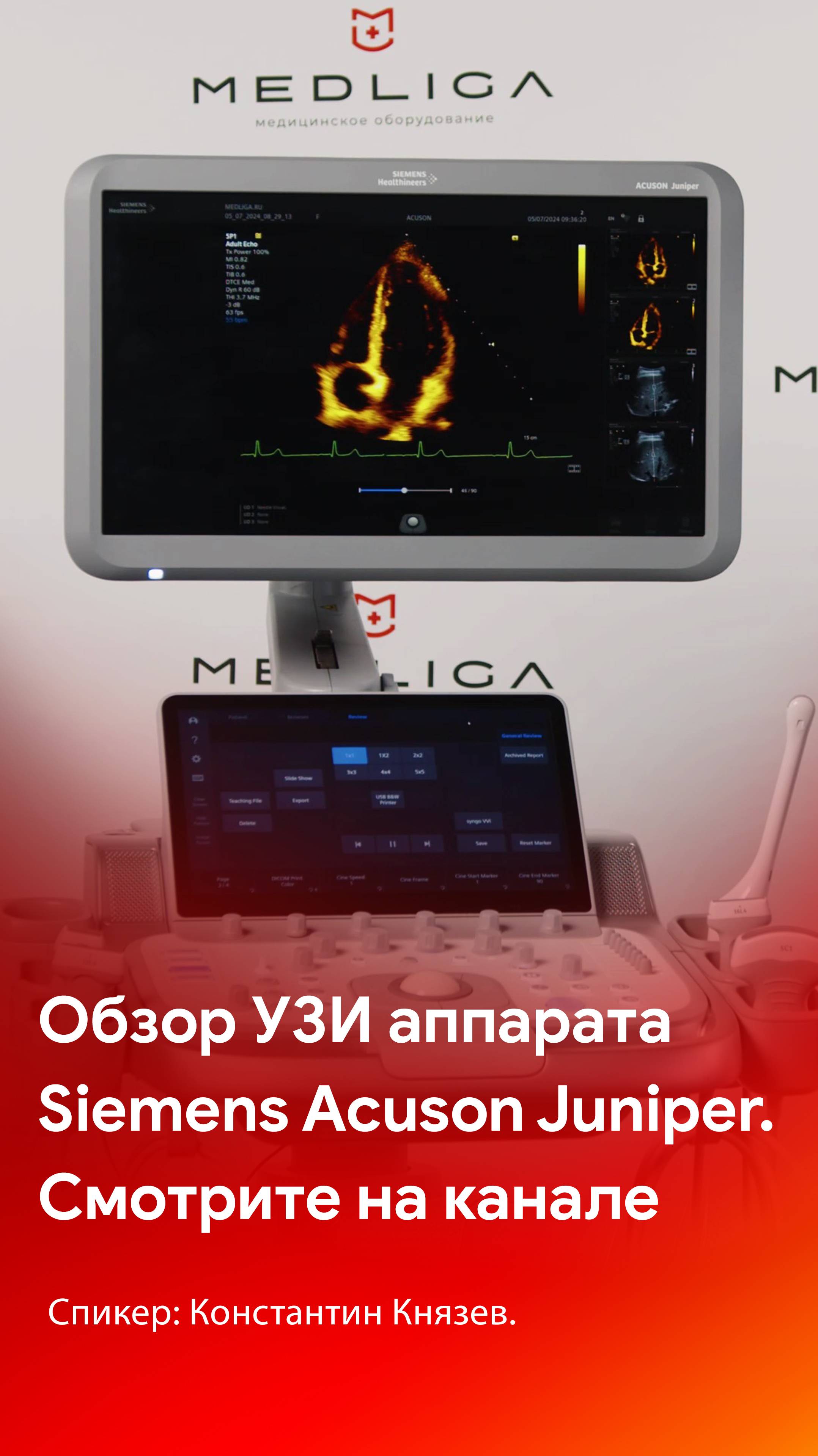 Siemens Acuson Juniper - смотрите обзор на канале MEDLIGA