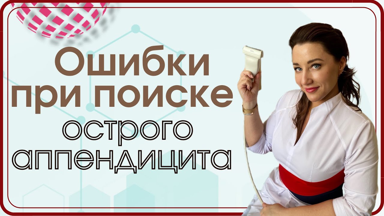 Ошибки при поиске острого аппендицита. Часть 1