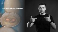 Уроки эндодонтии. Пилотная серия: обтурация сходящихся каналов