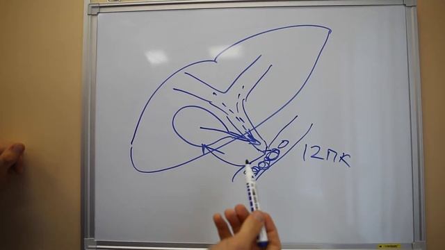 1 выпуск "Хирургия, понятная всем"-желчнокаменная болезнь