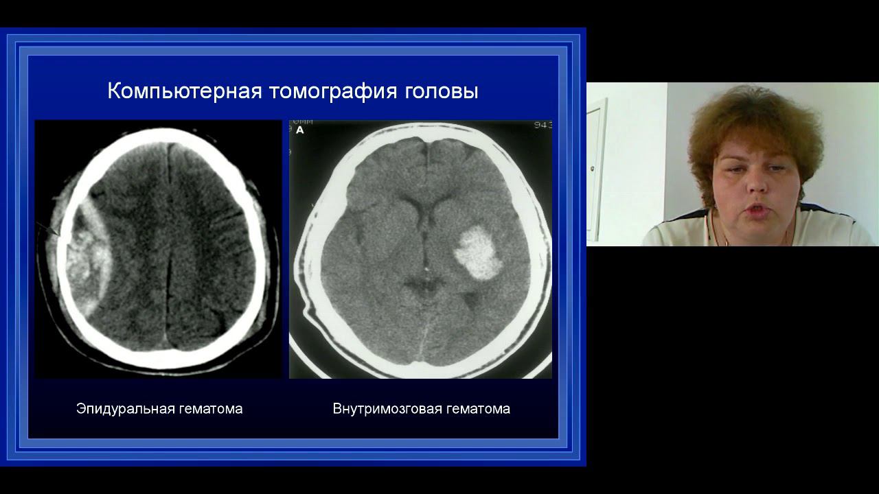 Методы лучевой диагностики