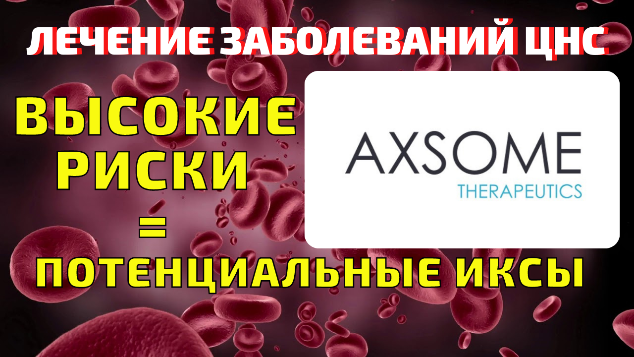 Axsome Therapeutics (AXSM) стоит ли покупать в 2021? Анализ акций и новости компании.