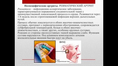 Лекция: Заболевания височно-нижнечелюстных суставов