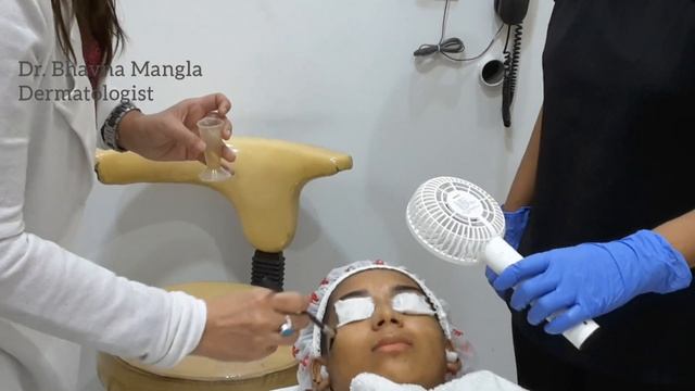 Chemical Peeling: Before & After | Chemical Peels | Acne Scar | Dr Bhavna