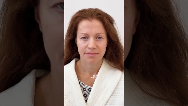 Омоложение верхней трети лица | Д. О. Типикин