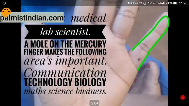Mole On Mercury Finger: Key To Success In Science, Oratory, And Business #mercuryline #mercurymount