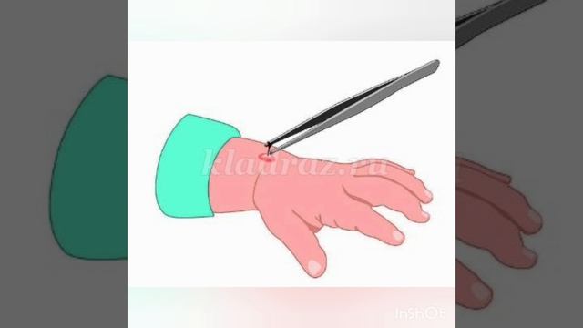 Смотреть видео онлайн