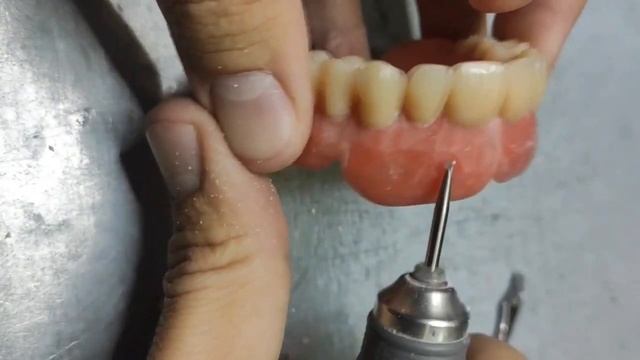 Работа с борами для текстурирования десны. Stippling Instrument.mp4