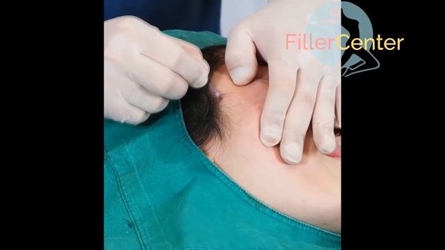 постановка новых мезонией DUAL COG TIME MACHNE обучающее видео FILLERCENTER