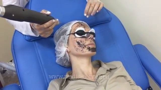Фракционный неодимовый лазер ? MERMAID ? RUIKD KOREA
