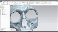 Как создать лицевой имплантат инструментами реинжиниринга в NX. Ver. 1.0 | Medical engineering NX