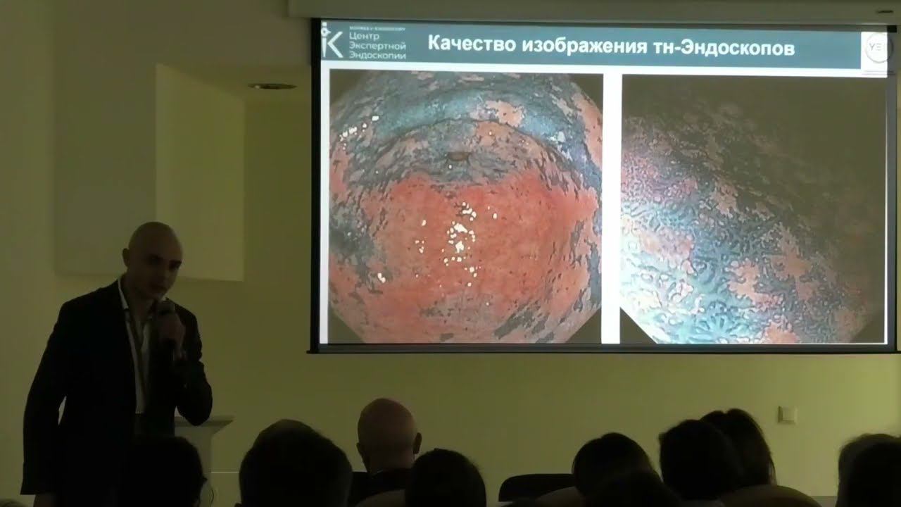 2024 06 22 Гастро04 Корнеев АА Трансназальная ЭГДС как способ улучшения переносимости
