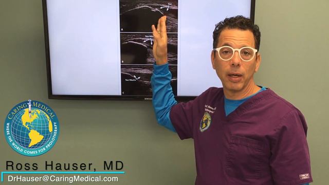 Patellar tendon tear repaired with PRP and Stem Cell Prolotherapy