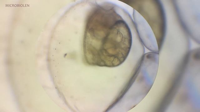 Эмбрион улитки Planorbis