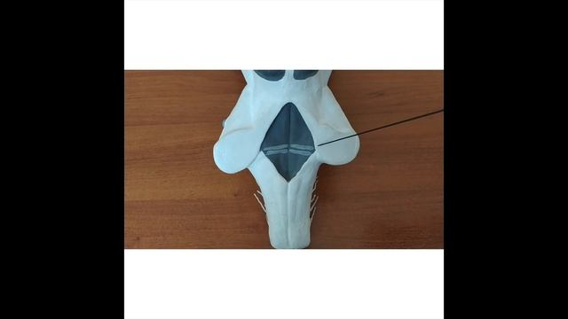 Ромбовидный мозг, мост, мозжечок, продолговатый мозг