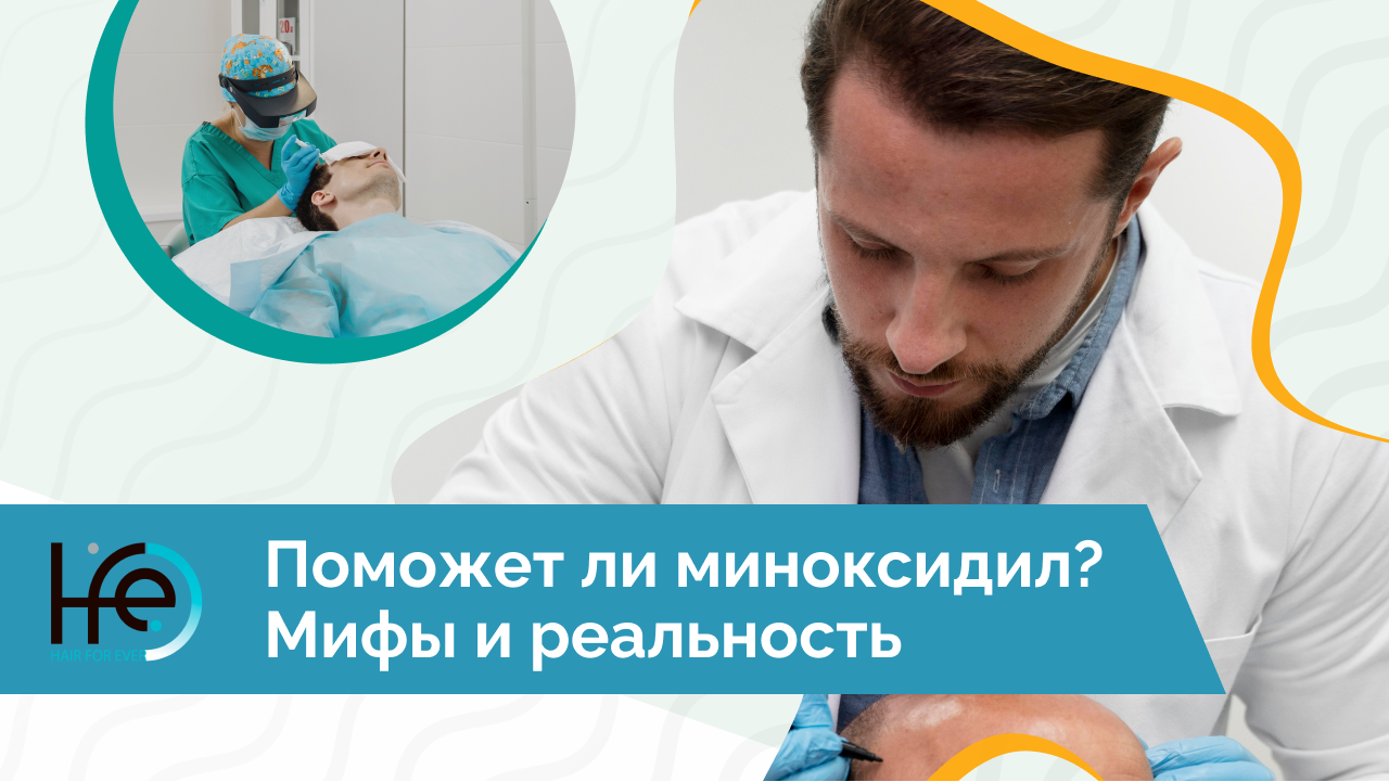Поможет ли миноксидил? Мифы и реальность