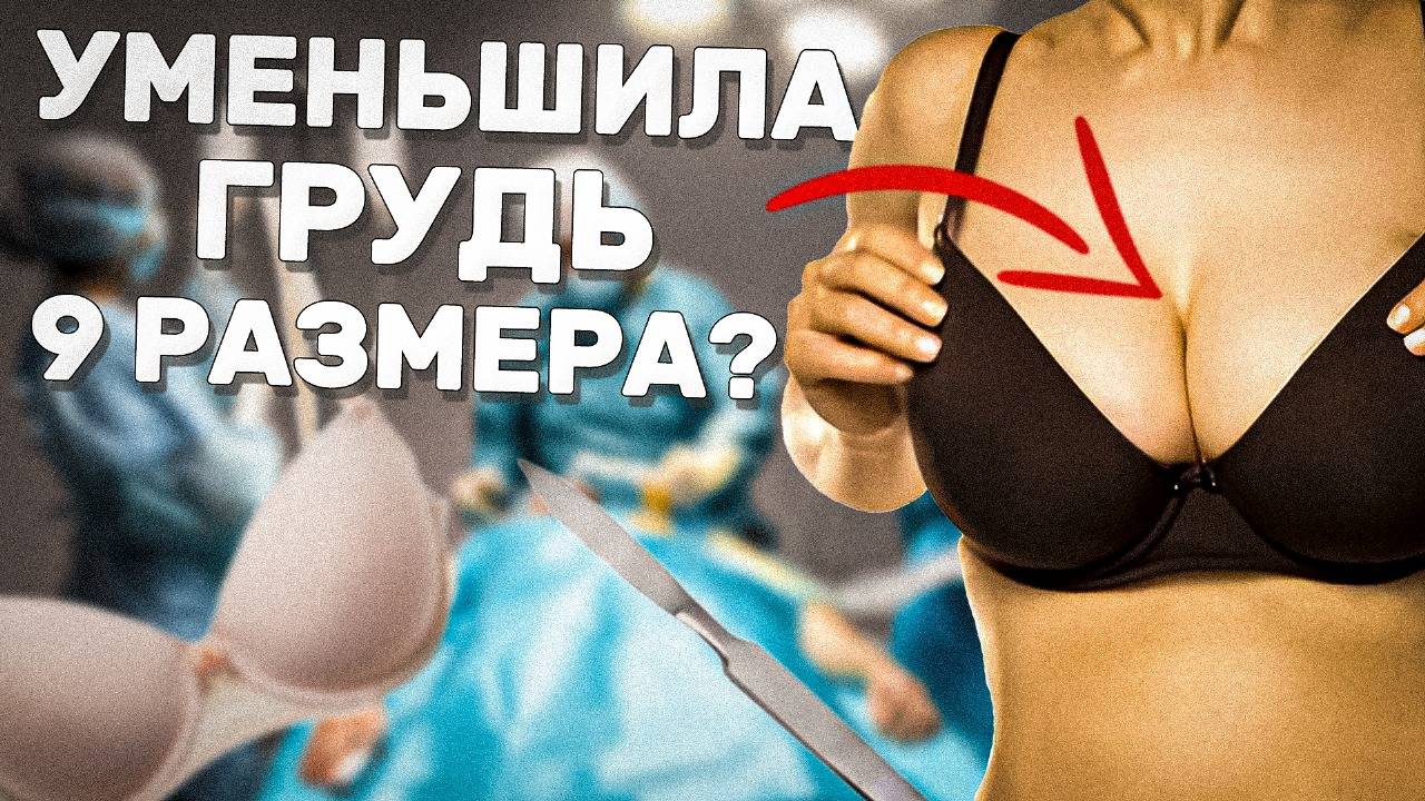 Операция по УМЕНЬШЕНИЮ ГРУДИ | Плюсы/Минусы/Риски | Редукционная маммопластика