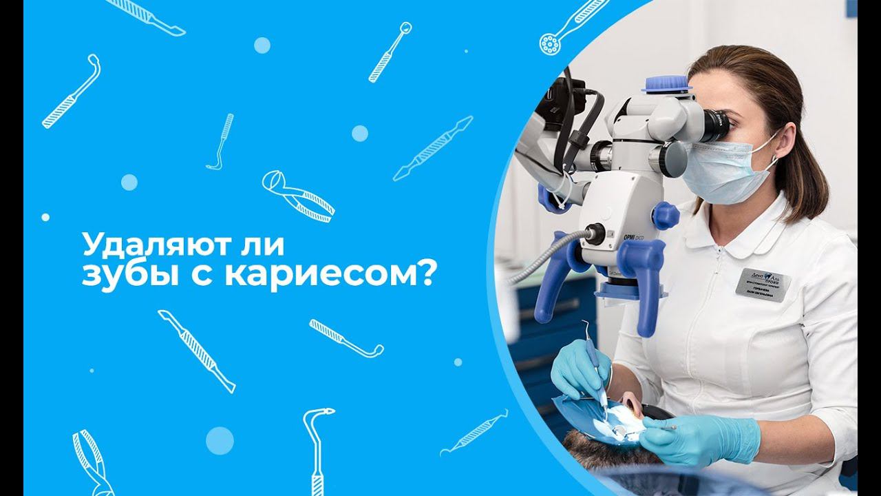 Удаляют ли зубы с кариесом?