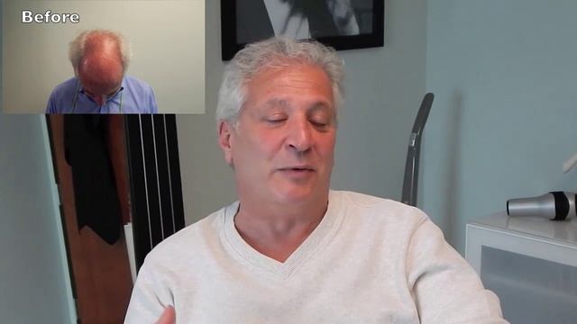 Hair Transplant Results - Before and After Hair Transplant (Dan)