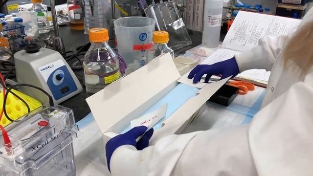SDS PAGE and Western Blot