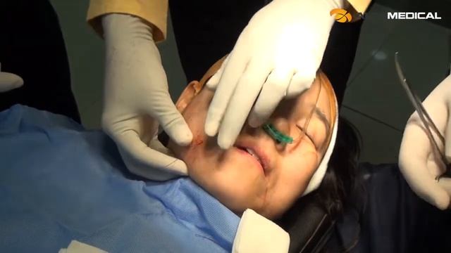 [Korea Seminar] Jawline, Dual Lifting