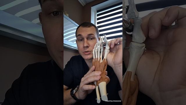 плоскостопие
