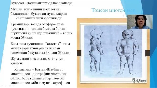 Видолекция Наследственные заболевания ЦНС. Часть 3