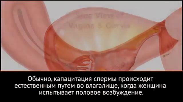 ALURA Мужское Бесплодие - решение проблемы!